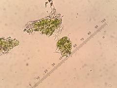 Chaenotheca xyloxena