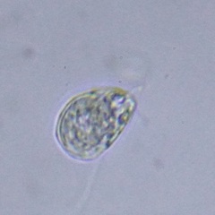 Protozoa