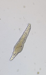 Bdelloidea