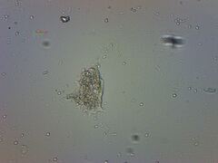 Amoebozoa
