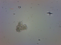 Amoebozoa
