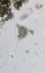 Campanella