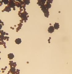 Badhamia utricularis