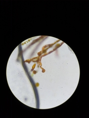Trentepohlia abietina