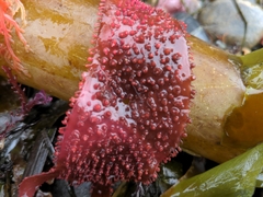 Chondracanthus