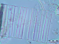 Fragilaria