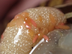 Anthessius navanacis