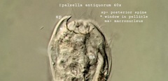 Epalxella antiquorum
