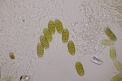 Cucurbitaria berberidis