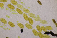 Cucurbitaria berberidis