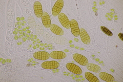 Cucurbitaria berberidis