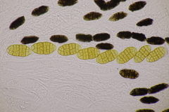 Cucurbitaria berberidis