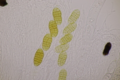 Cucurbitaria berberidis