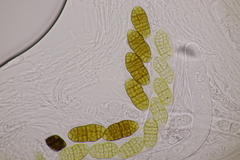 Cucurbitaria berberidis