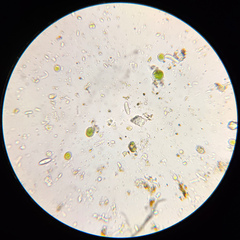 Athallia pyracea