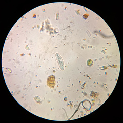 Athallia pyracea