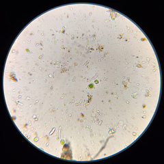 Athallia pyracea