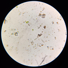 Athallia pyracea