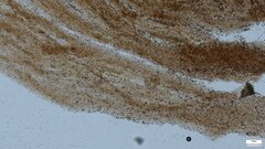 Psathyrella piluliformis