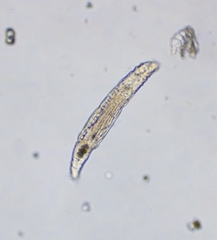Bdelloidea