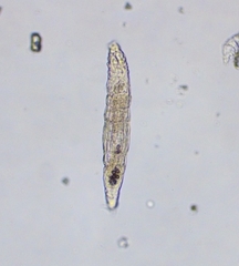 Bdelloidea