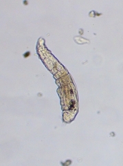 Bdelloidea