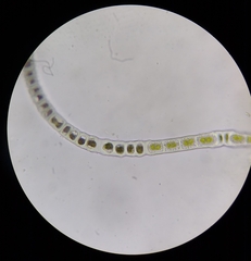 Zygogonium ericetorum