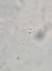 Hartmannellidae