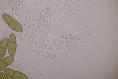 Pleomassaria carpini