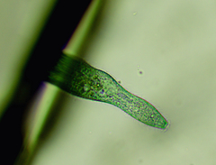 Stentor multiformis