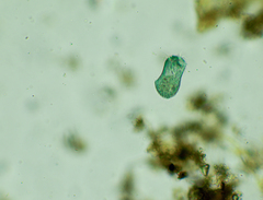 Stentor multiformis