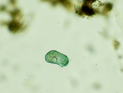 Stentor multiformis