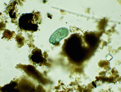 Stentor multiformis