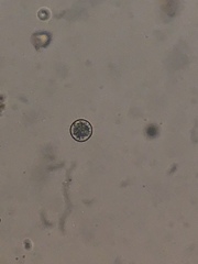 Heliozoa