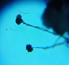 Aspergillus