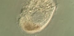 Brachonella spiralis