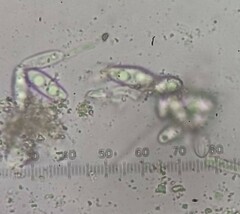 Squamarina lentigera