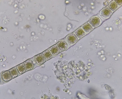 Zygogonium ericetorum