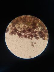 Badhamia capsulifera