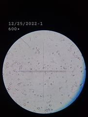 Tricholoma manzanitae