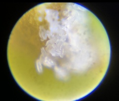 Acalitus phloeocoptes