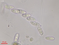 Melanopsamma pomiformis