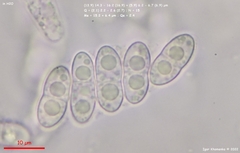 Melanopsamma pomiformis