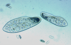 Paramecium
