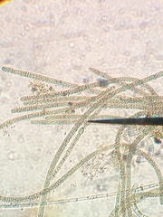 Monactinus simplex