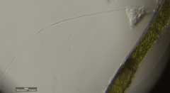 Vorticella