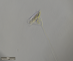 Vorticella