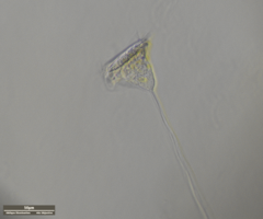 Vorticella