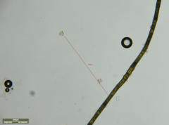Vorticella
