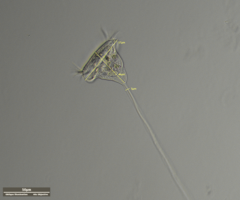 Vorticella